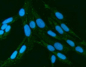 Anti-Kindlin 2/FERMT2 Antibody