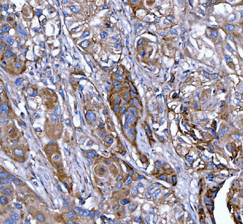Anti-Kindlin 2/FERMT2 Antibody