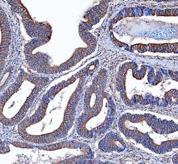 Anti-Kindlin 2/FERMT2 Antibody