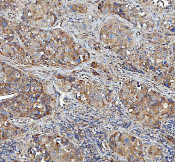 Anti-Kindlin 2/FERMT2 Antibody