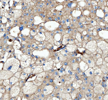 Anti-Kindlin 2/FERMT2 Antibody
