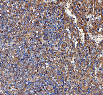 Anti-Kindlin 2/FERMT2 Antibody
