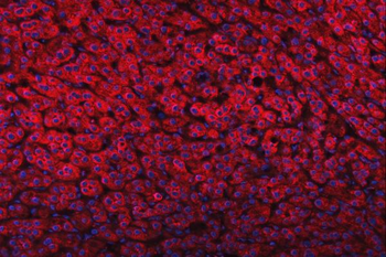 Anti-FADS1 Antibody