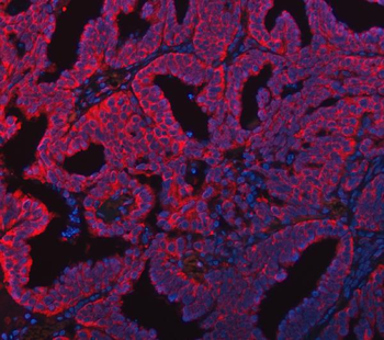 Anti-FADS1 Antibody