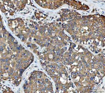 Anti-FADS1 Antibody