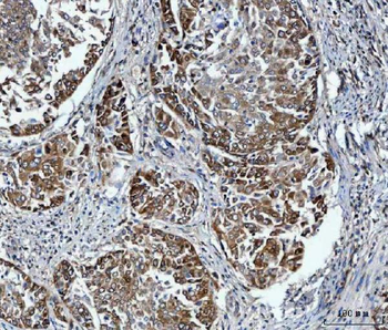 Anti-FADS1 Antibody