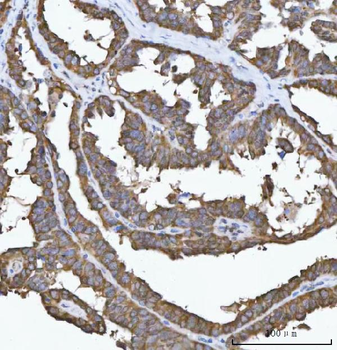 Anti-FADS1 Antibody