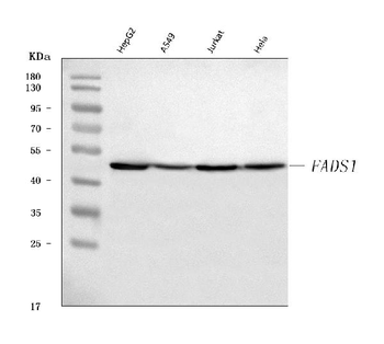 Anti-FADS1 Antibody