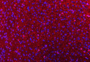 Anti-CNPase/CNP Antibody