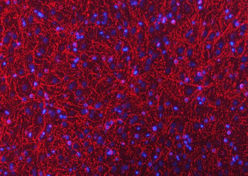 Anti-CNPase/CNP Antibody