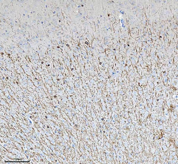 Anti-CNPase/CNP Antibody