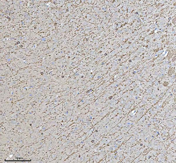Anti-CNPase/CNP Antibody