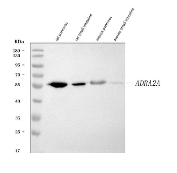 Anti-alpha 2a Adrenergic Receptor/ADRA2A Antibody