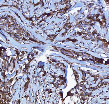 Anti-GPCR RDC1/CXCR-7/ACKR3 Antibody