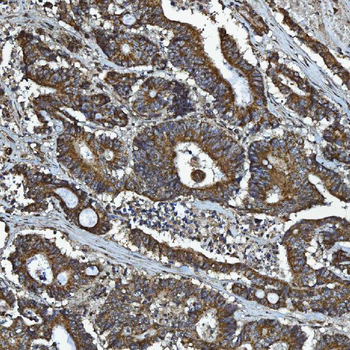 Anti-GPCR RDC1/CXCR-7/ACKR3 Antibody