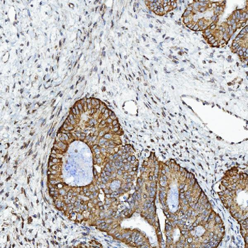 Anti-GPCR RDC1/CXCR-7/ACKR3 Antibody