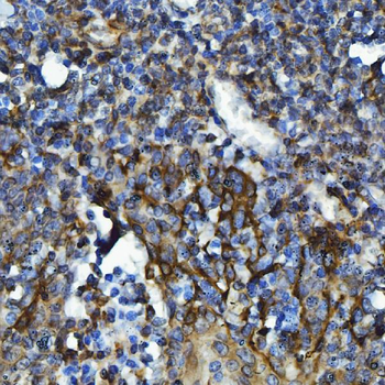 Anti-GPCR RDC1/CXCR-7/ACKR3 Antibody