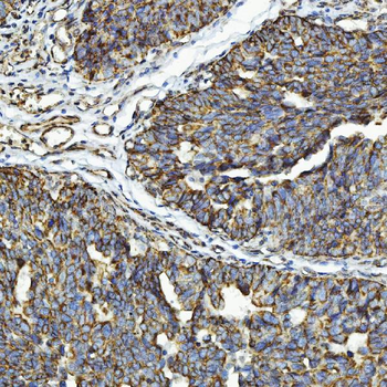 Anti-GPCR RDC1/CXCR-7/ACKR3 Antibody