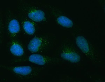Anti-ZNRF3 Antibody