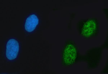ZNF609 Antibody