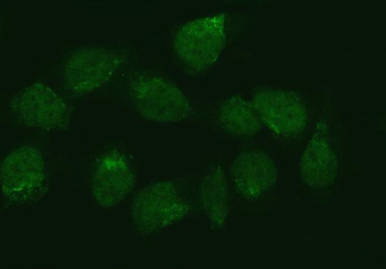 Anti-ZMYND8 Antibody