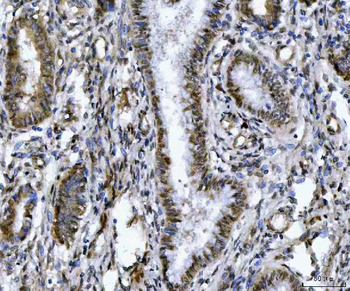 Anti-ZMYND8 Antibody