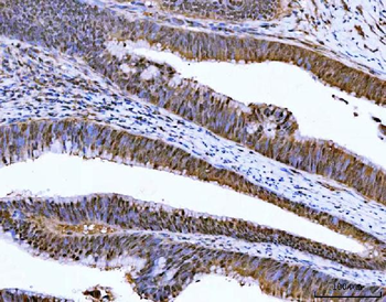 Anti-ZMYND8 Antibody
