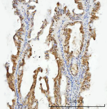 Anti-ZMYND8 Antibody
