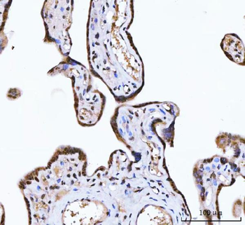 Anti-ZMYND8 Antibody