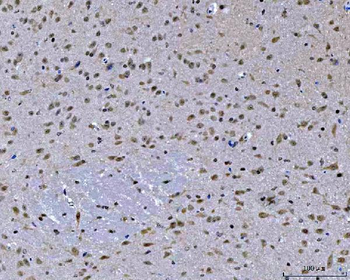 Anti-ZMYND8 Antibody