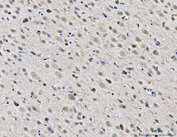 Anti-ZMYND8 Antibody