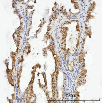 ZMYND8 Antibody