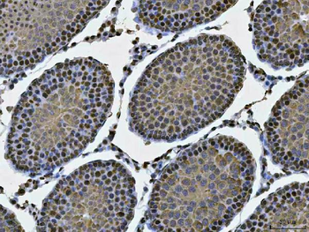 Anti-MSY2/YBOX2/YBX2 Antibody