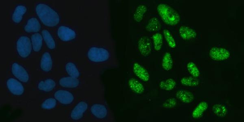 Anti-Exportin-5/XPO5 Antibody