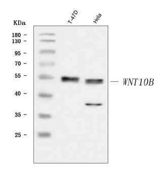 Anti-WNT10B Antibody