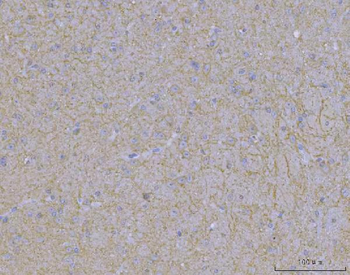 Anti-WDR7 Antibody