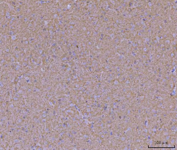 Anti-WDR7 Antibody