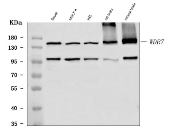 Anti-WDR7 Antibody