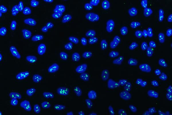 Anti-WDR3 Antibody
