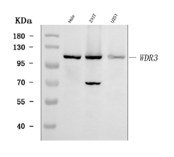 Anti-WDR3 Antibody