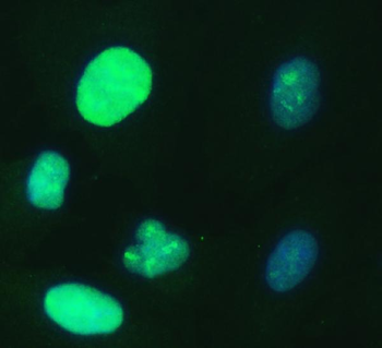 Anti-UBE2S Antibody