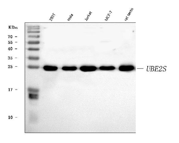 Anti-UBE2S Antibody