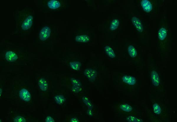 Anti-Ubc13/UBE2N Antibody