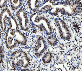 Anti-Ubc13/UBE2N Antibody