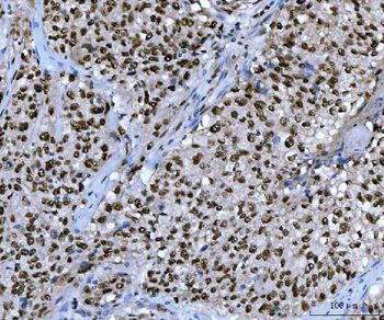 Anti-Ubc13/UBE2N Antibody