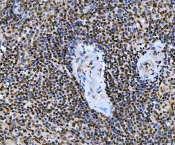 Anti-Ubc13/UBE2N Antibody