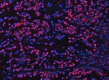 Anti-UBC12/UBE2M Antibody