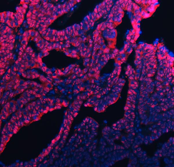 Anti-UBC12/UBE2M Antibody