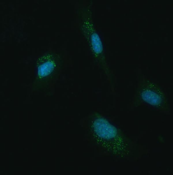 Anti-UBC12/UBE2M Antibody