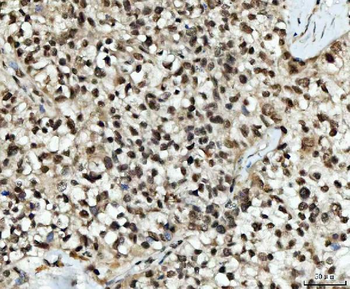 Anti-UBC12/UBE2M Antibody